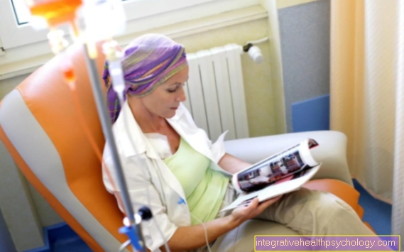 chemotherapy