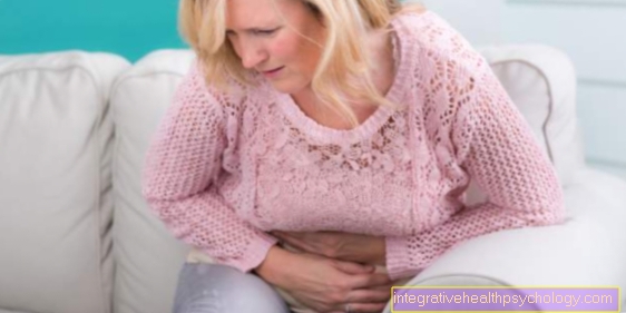 Ulcerative colitis