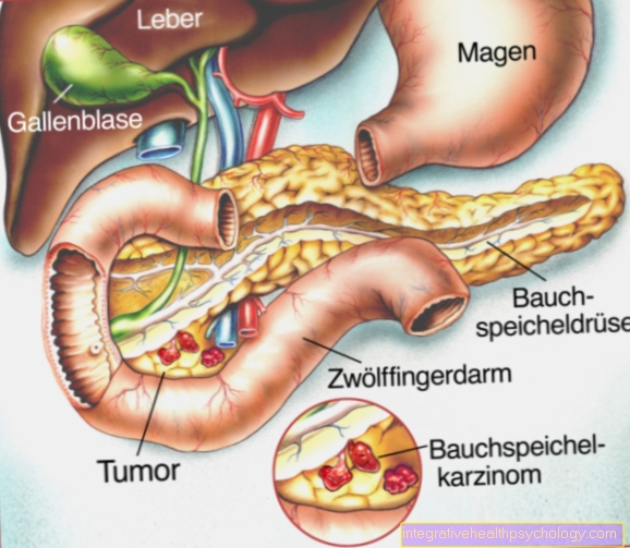 Diagnosis esofagitis