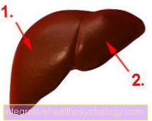 Cirrhosis of the liver