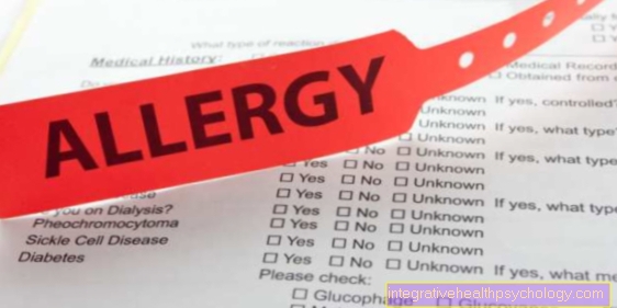 Алергија на никл