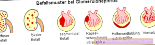 Formează glomerulonefrită