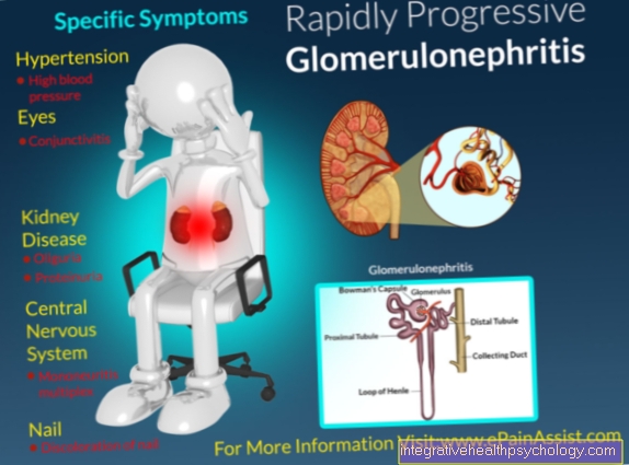 Glomerulonefrīts