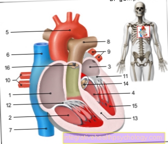 Rối loạn nhịp tim