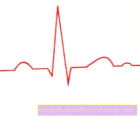 Cardiac arrhythmias consequences