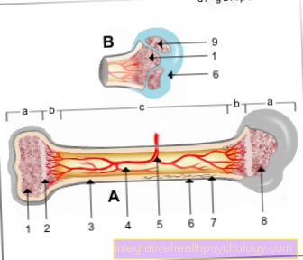 Kostni tumor