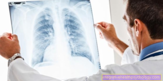 Pneumonia köhögés nélkül