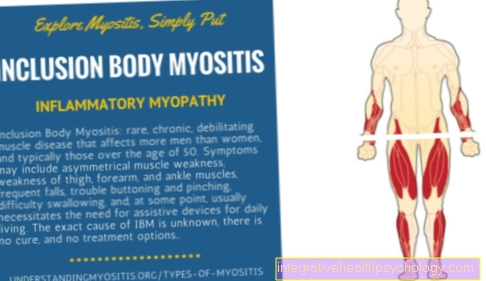 Myositis