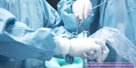 Diverticulitis Surgery - อันตรายคืออะไร?