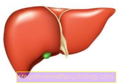 Primer biliáris cirrhosis