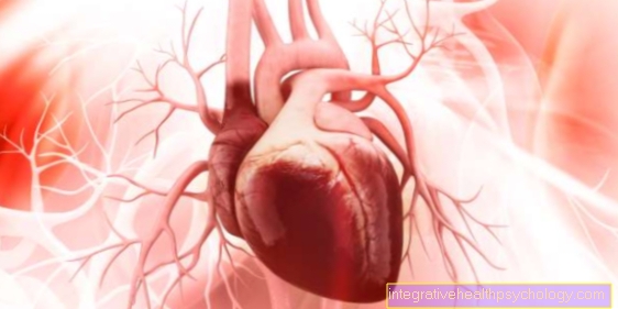 Terapi aneurisma aorta