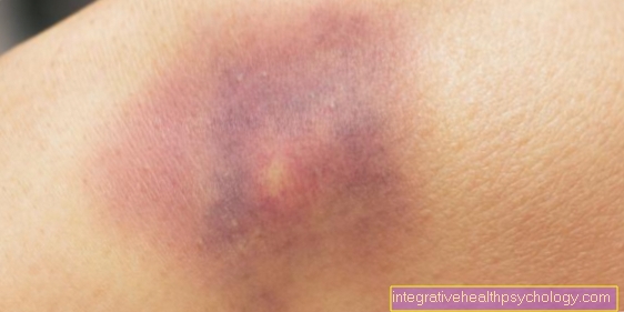 Bruise in the child