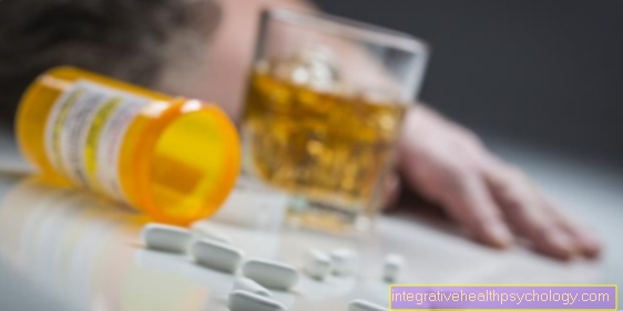 Ibuprofen in alkohol - sta združljiva?