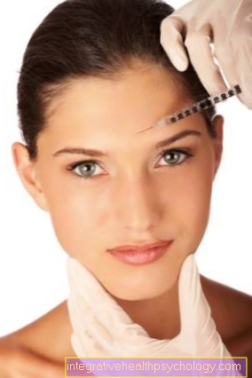 Efectos secundarios de Botox®