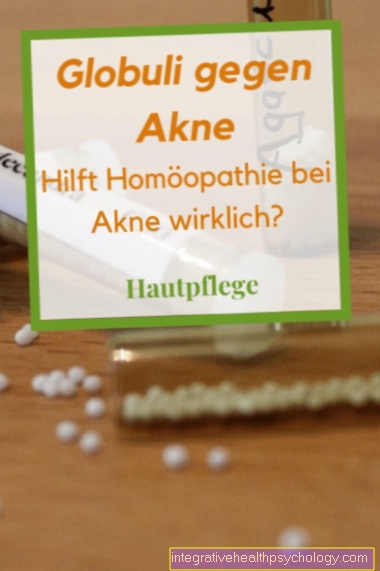 Homeopatija za akne