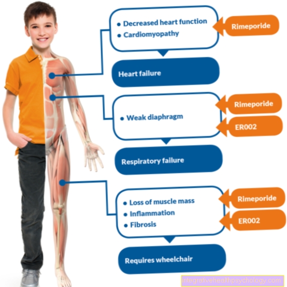 Duchenne पेशी dystrophy