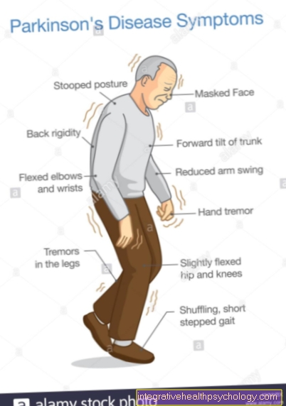 A Parkinson-kór tünetei