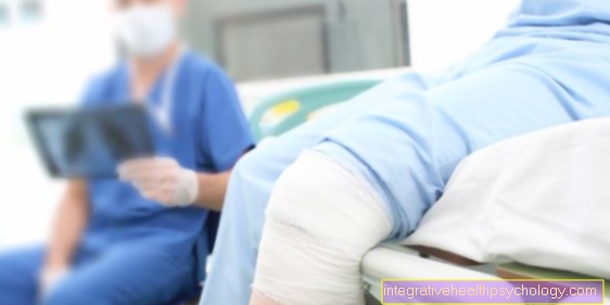 Arthrofibrosis i knæet