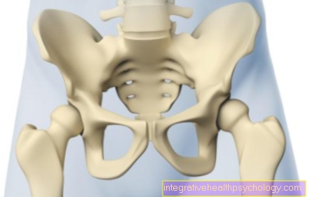 Pelvic ring fracture