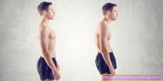 Exercises against a hunched back