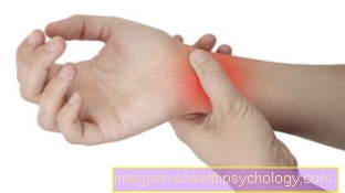 CRPS (Complex Regional Pain Syndrome)