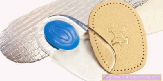 Insoles for a calcaneal spur