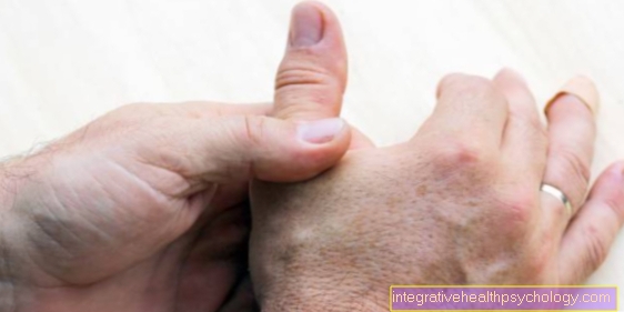 Ganglion on the finger