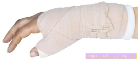 Zaceli zlom scaphoid