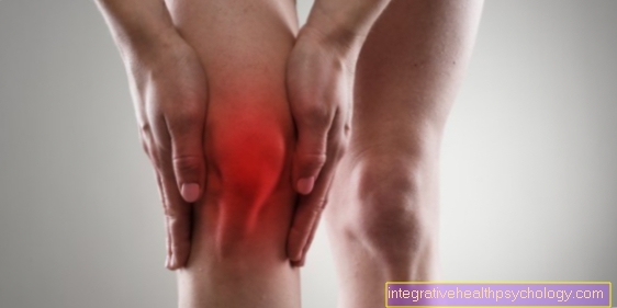 Patellar lateralization