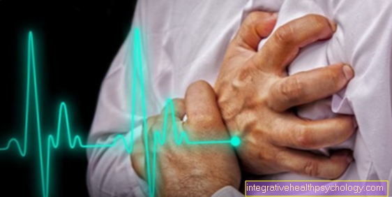 Kalp krizi belirtisi olarak sol kolda ağrı