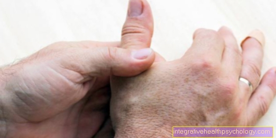 Pain between thumb and forefinger