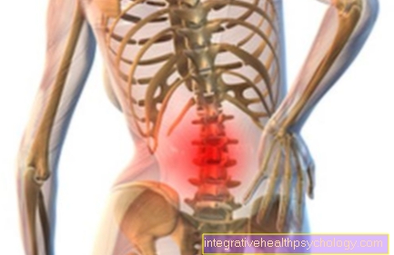 Spinal canal stenosis in the lumbar spine