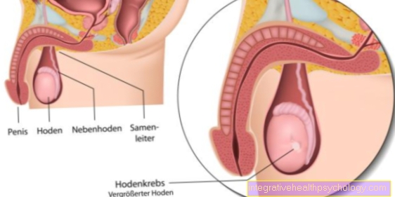 Kanker testis