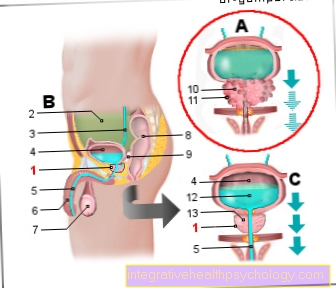 Prostate cancer