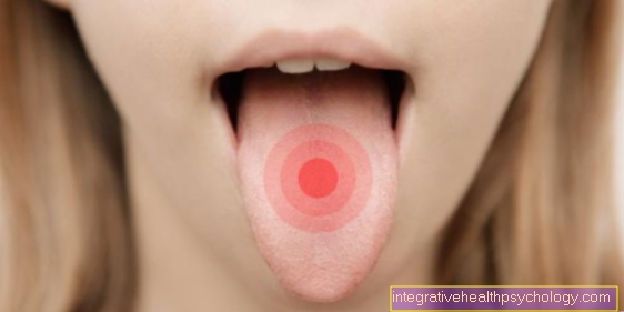 Pain in the tongue