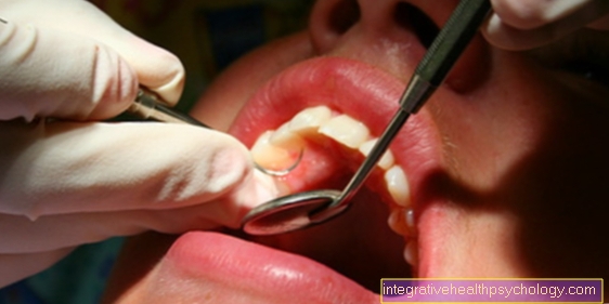 ¿Qué tan contagiosa es la enfermedad periodontal?