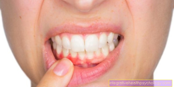 Hvad er den bedste måde at stoppe blødende tandkød på?